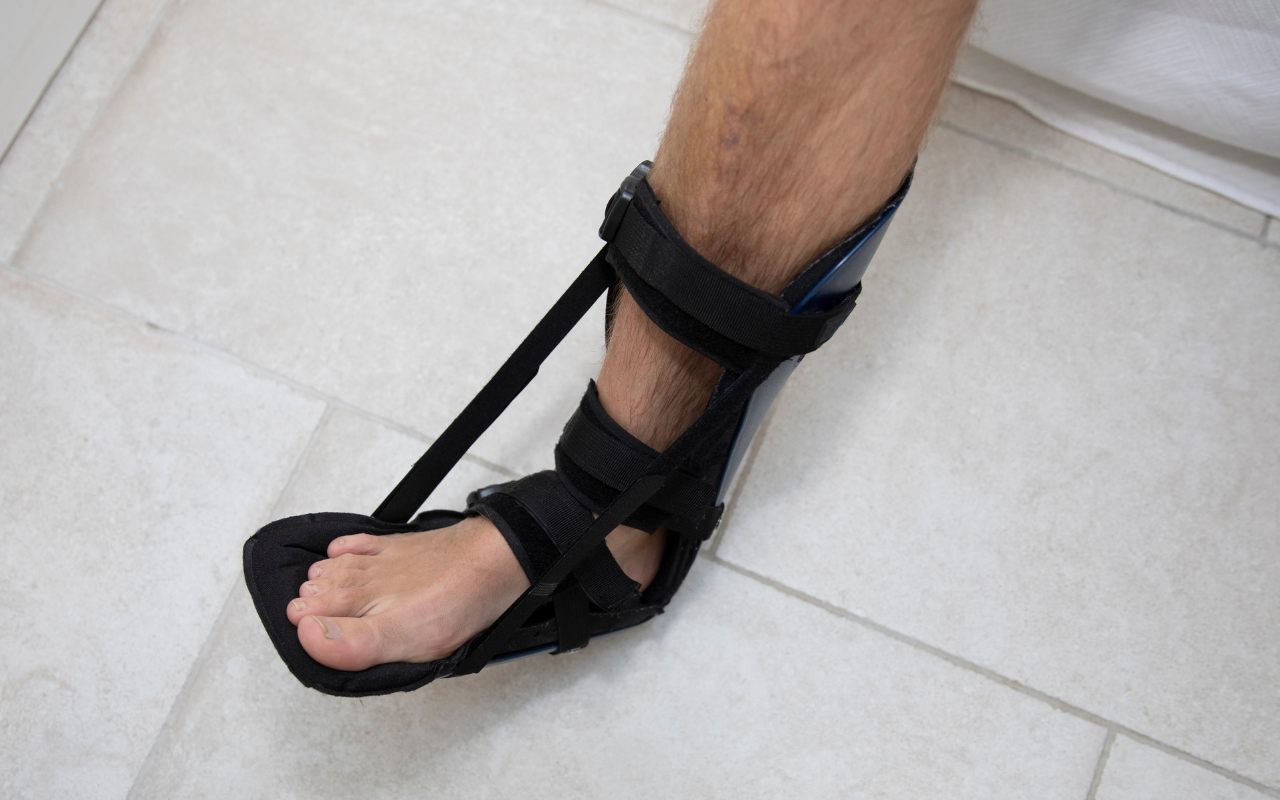 A night splint worn on the foot to maintain plantar fascia stretch during sleep