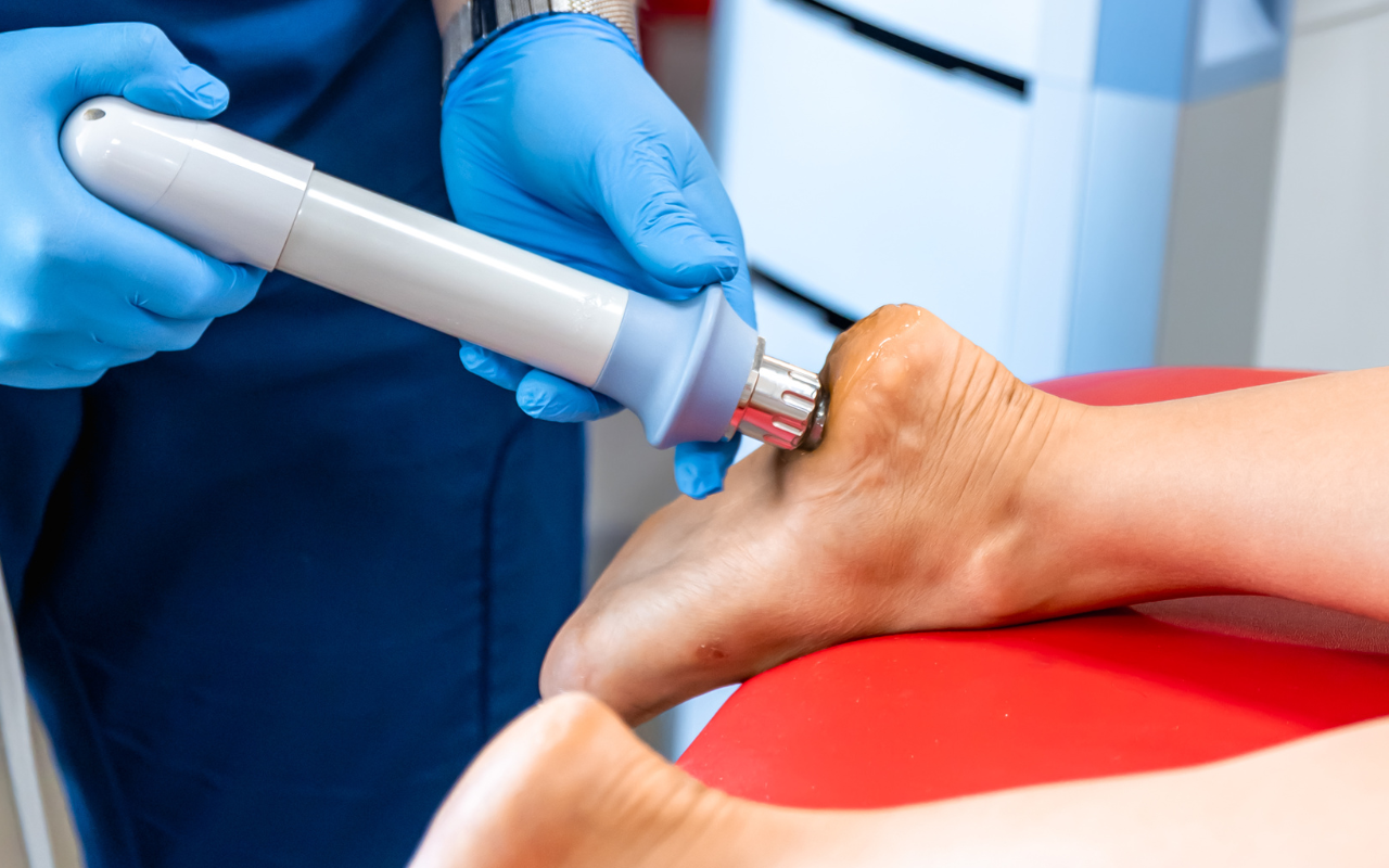 Shockwave therapy being applied to the heel to treat chronic plantar fasciitis